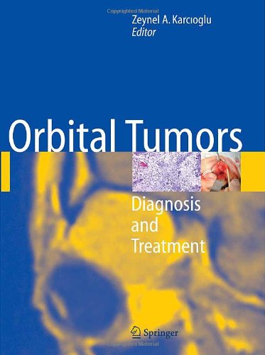 Orbital Tumors Diagnosis And Treatment 1st Edition Zeynel A Karcioglu