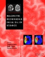Magnetic Resonance Imaging In Stroke 1st Edition Stephen M Davis Marc Fisher Steven Warach