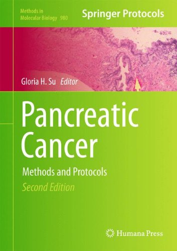 Pancreatic Cancer Methods And Protocols 2nd Edition Hanno Matthaei