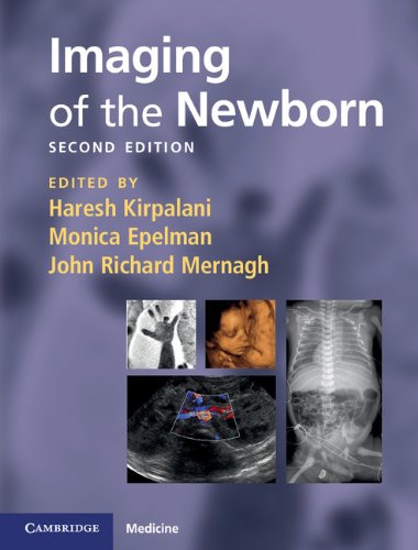 Imaging Of The Newborn 2nd Edition Haresh Kirpalani Monica Epelman John Mernagh