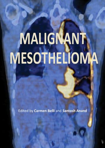Malignant Mesothelioma Edited By Carmen Belli And Santosh Anand