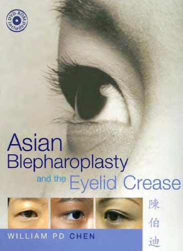 Asian Blepharoplasty And The Eyelid Crease W Chen