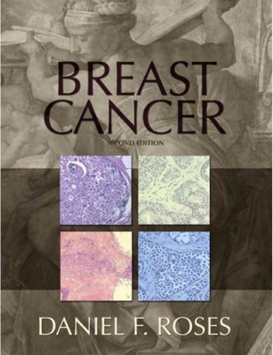 Breast Cancer 2nd Ed Daniel F Roses