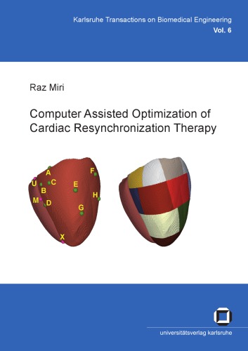Computer Assisted Optimization Of Cardiac Resynchronization Therapy Raz Miri