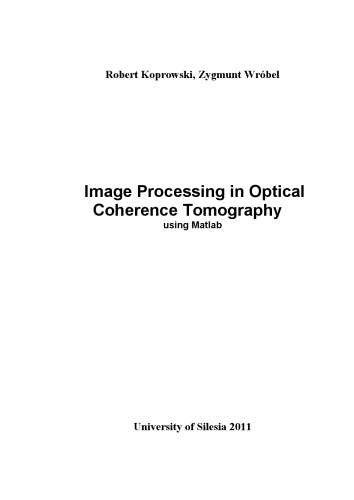Image Processing In Optical Coherence Tomography Using Matlab Robert Koprowski Zygmunt Wrobel