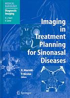 Imaging In Treatment Planning For Sinonasal Diseases R Maroldi P Nicolai A R Antonelli Et Al