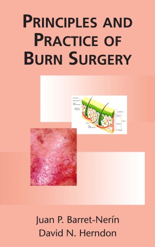 Principles And Practice Of Burn Surgery Juan P Barret David N Herndon