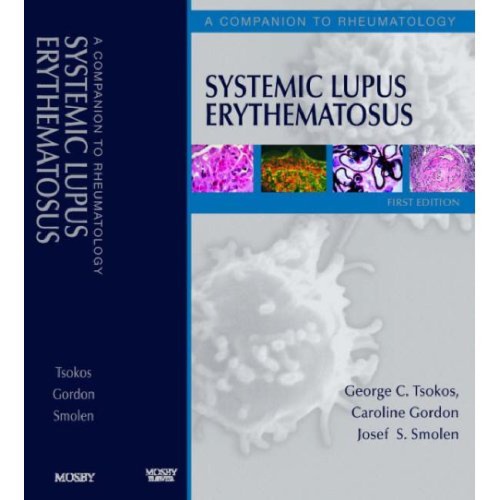 Systemic Lupus Erythematosus A Companion To Rheumatology G Tsokos