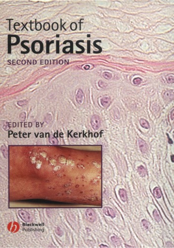 Textbook Of Psoriasis Petrus Cornelis Maria Van De Kerkhof
