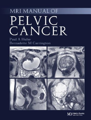 Mri Manual Of Pelvic Cancer Paul Hulse Bernadette M Carrington