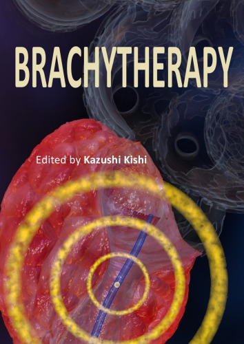 Brachytherapy K Kishi