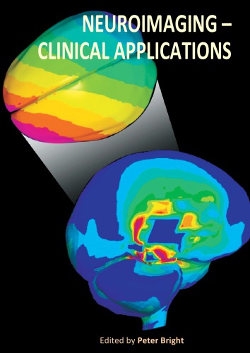 Neuroimaging Clinical Applications P Bright