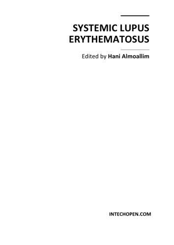 Systemic Lupus Erythematosus H Almoallim