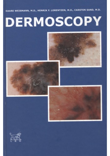 Dermoscopy Kaare Weismann Henrik F Lorentzen Carsten Sand Leo Pharma