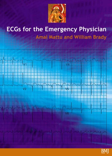 Ecgs For The Emergency Physician Amal Mattu William Brady