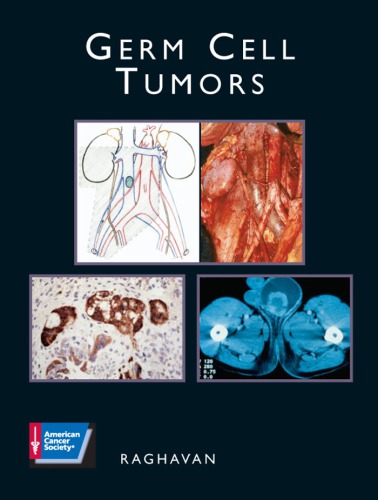 Germ Cell Tumors Derek Raghavan