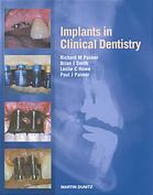 Implants In Clinical Dentistry Richard M Palmer Et Al