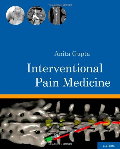 Interventional Pain Medicine 1st Edition Anita Gupta