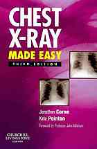 Chest Xray Made Easy 3rd Edition Jonathan Corne Kate Pointon