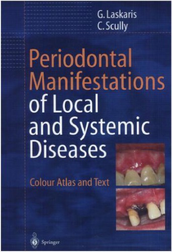 Periodontal Manifestations Of Local And Systemic Diseases Colour Atlas And Text George Laskaris