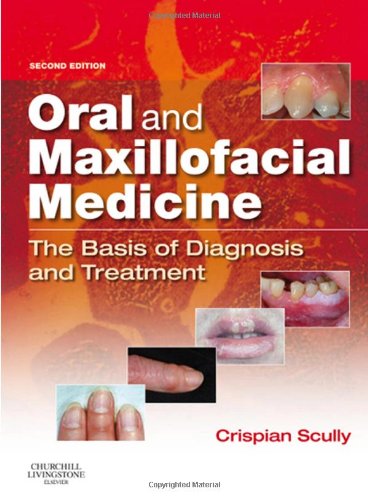 Oral And Maxillofacial Medicine The Basis Of Diagnosis And Treatment 2e 2nd Edition Crispian Scully