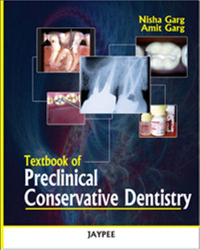 Textbook Of Preclinical Conservative Dentistry Nisha Garg Amit Garg