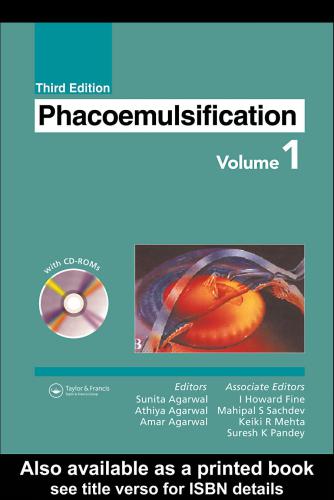 Phacoemulsification Volume I Sunita Agarwal Et Al
