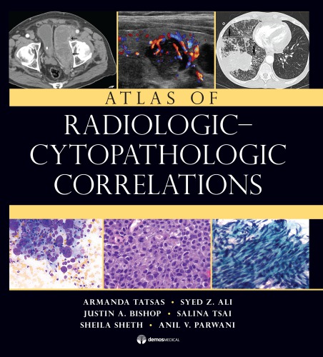 Atlas Of Radiologiccytopathologic Correlations 1 Edition Armanda Tatsas