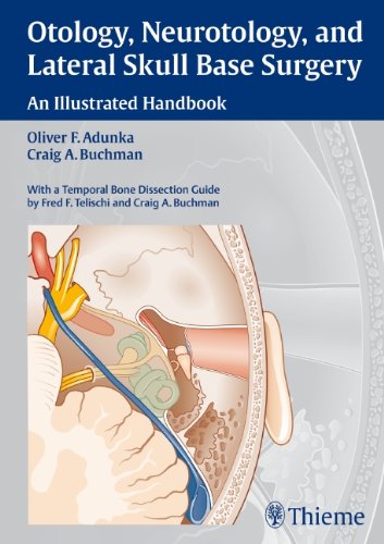 Otology Neurotology And Lateral Skull Base Surgery An Illustrated Handbook 1 Ill Oliver F Adunka
