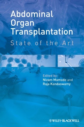Abdominal Organ Transplantation State Of The Art 1st Edition Nizam Mamode
