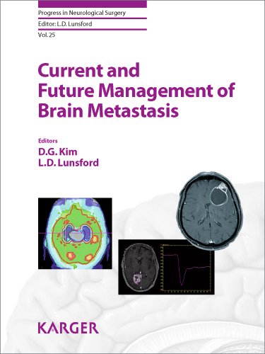 Current And Future Management Of Brain Metastasis 1st Edition Dg Kim