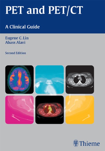 Pet And Petct A Clinical Guide 2nd Ed Lin Eugene Alavi Abass