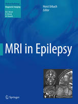 Mri In Epilepsy 1st Edition Horst Urbach Jrg Wellmer Auth