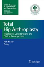Total Hip Arthroplasty Tribological Considerations And Clinical Consequences 1st Edition Michael M Morlock