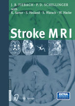 Stroke Mri 1st Edition Dr Med Jochen B Fiebach Privdoz Dr Med Peter D Schellinger