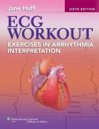 Ecg Workout Exercises In Arrhythmia Interpretation Sixth Jane Huff