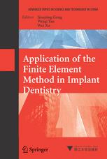 Application Of The Finite Element Method In Implant Dentistry 1st Edition N Krishnamurthy Auth