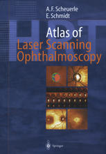 Atlas Of Laser Scanning Ophthalmoscopy 1st Edition Alexander F Scheuerle