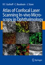 Atlas Of Confocal Laser Scanning Invivo Microscopy In Ophthalmology Principles And Applications In Diagnostic And Therapeutic Ophthalmology 1st Edition Profdr Med Rudolf F Guthoff