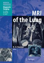 Mri Of The Lung Jrgen Biederer Auth Hansulrich Kauczor Eds