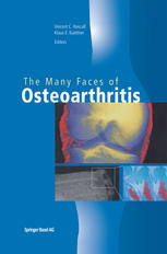The Many Faces Of Osteoarthritis 1st Edition Audrey Mcalinden