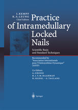 Practice Of Intramedullary Locked Nails Scientific Basis And Standard Techniques Recommended By Association Internationale Pour Iosteosynthese Dynamique Aiod 1st Edition I Kempf