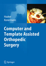Computer And Template Assisted Orthopedic Surgery 1st Edition Prof Dr Rolf Haaker Auth