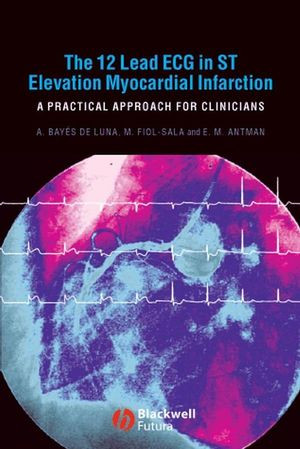 The 12lead Ecg In St Elevation Myocardial Infarction A Practical Approach For Clinicians Antoni Bays De Luna