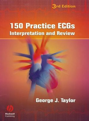 150 Practice Ecgs Interpretation And Review Third Edition George J Taylorauth