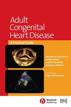 Adult Congenital Heart Disease A Practical Guide Michael A Gatzoulis
