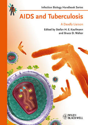 Aids And Tuberculosis A Deadly Liaison Stefan H E Kaufmann