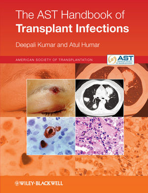 The Ast Handbook Of Transplant Infections Kumar