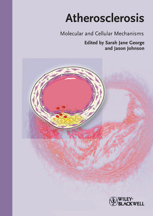 Atherosclerosis Molecular And Cellular Mechanisms Sarah Jane George