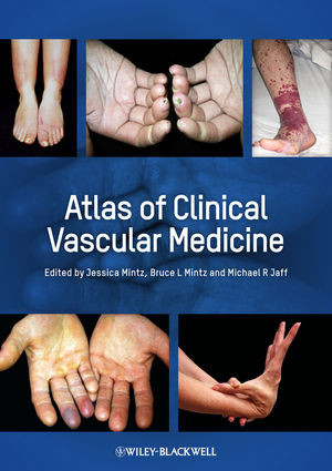Atlas Of Clinical Vascular Medicine Jessica Mintz Bruce L Mintz
